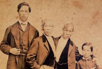 Životopisy, príbehy, fakty, fotografie Siamské dvojčatá so zrastenými hlavami